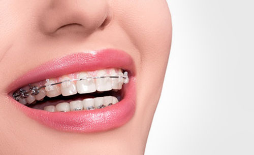servicio-ortodoncia-belen-villacastin-clinica-dental